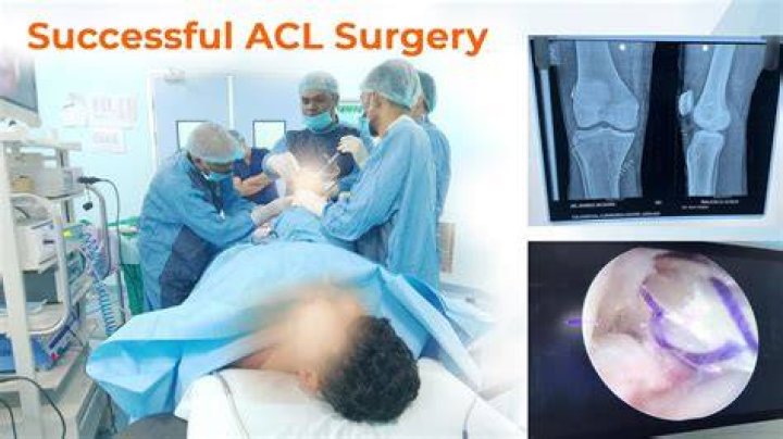 Is ACL surgery outpatient?