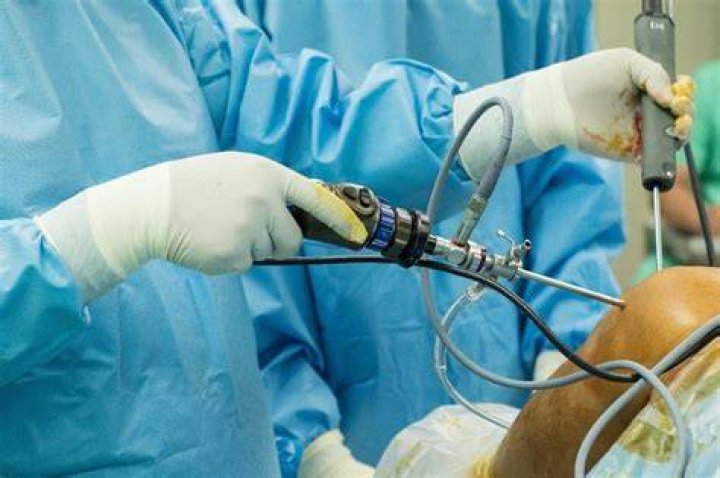 Is ACL surgery recommended?