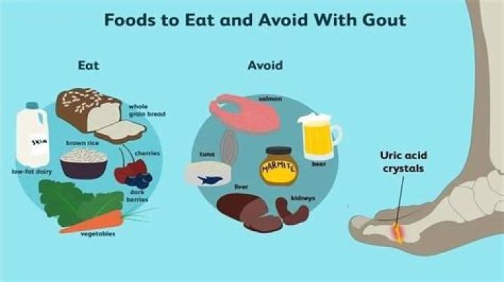 Is chicken OK for gout?
