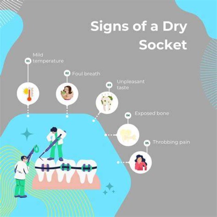 Is dry socket pain unbearable?