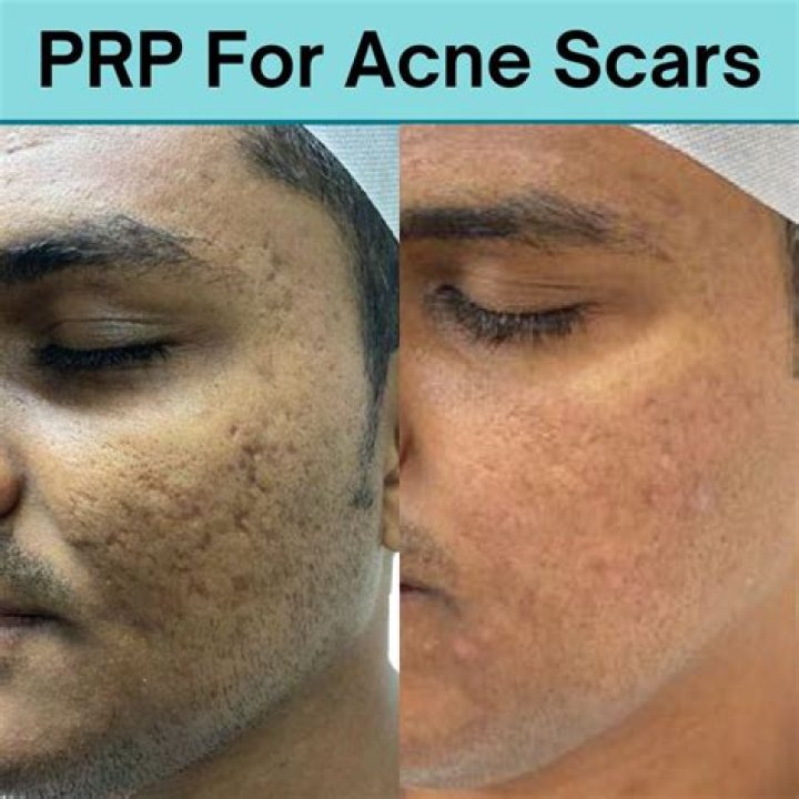 Is Eucerin good for scars?