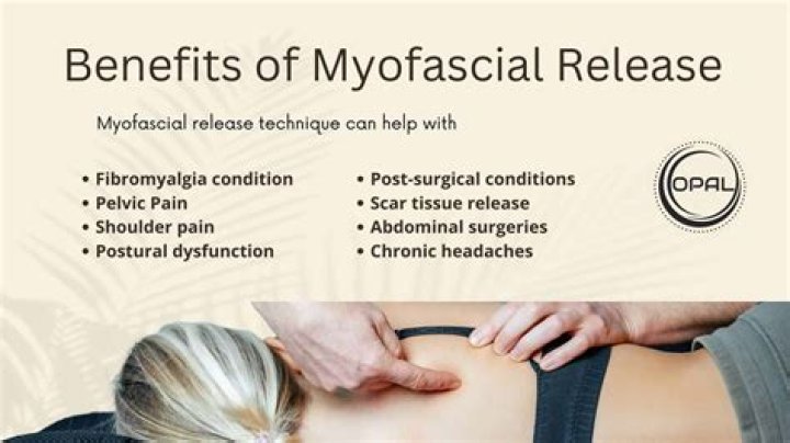 Is fascia the same as myofascial?