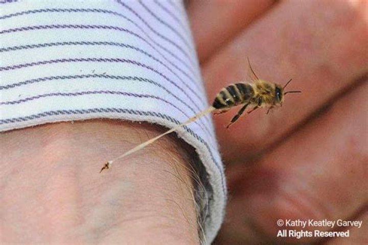 Is honey bee sting poisonous?