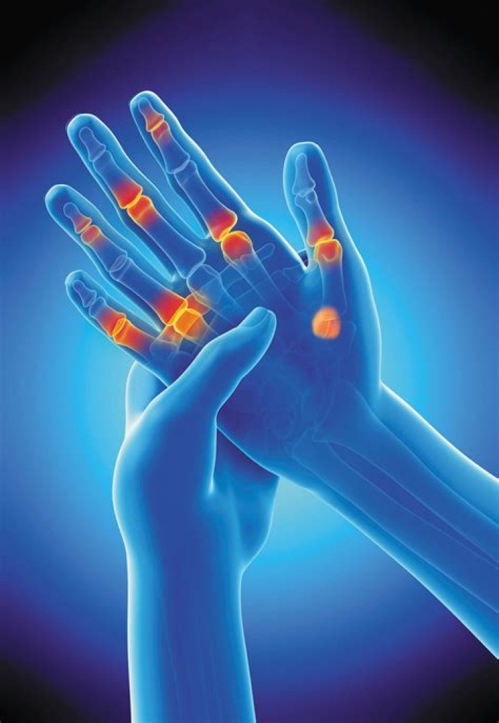 Is it good to massage arthritic fingers?
