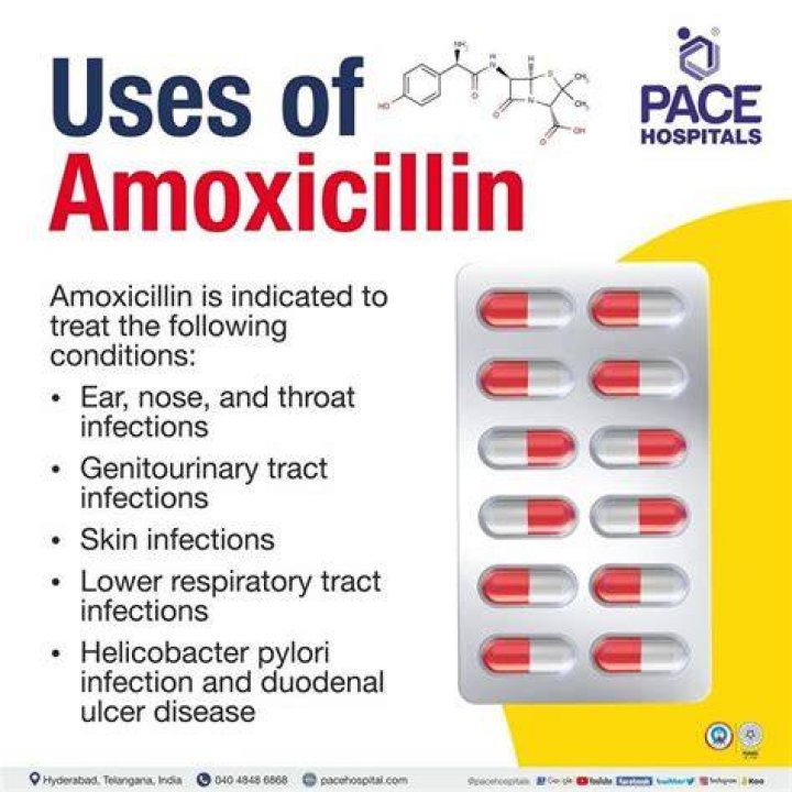 Is it necessary to take amoxicillin after tooth extraction?