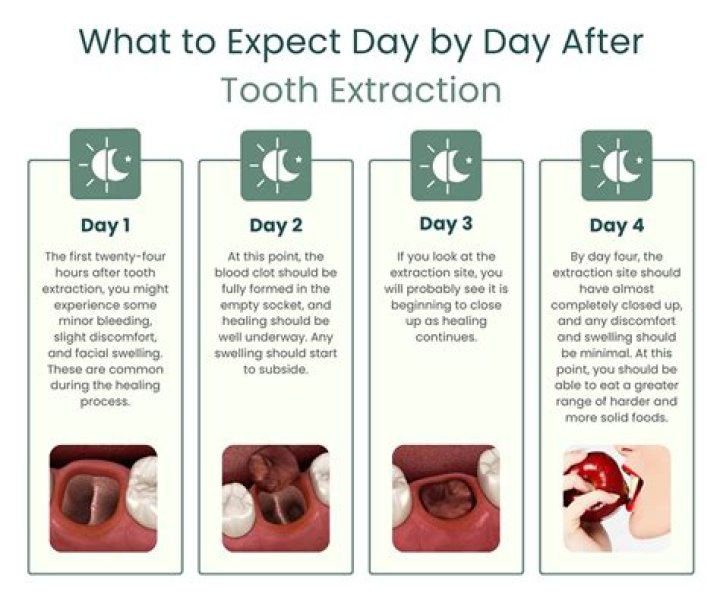 Is it normal to have pain 4 days after wisdom teeth removal?