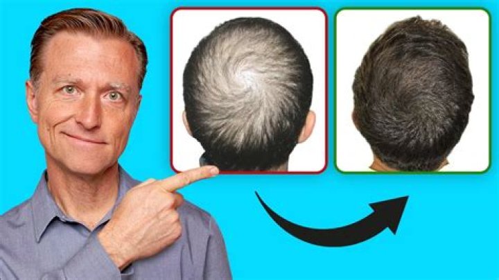 Is it possible to regrow hair on forehead?