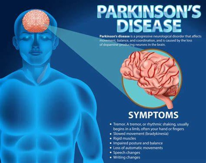 Is Parkinson's terminal?