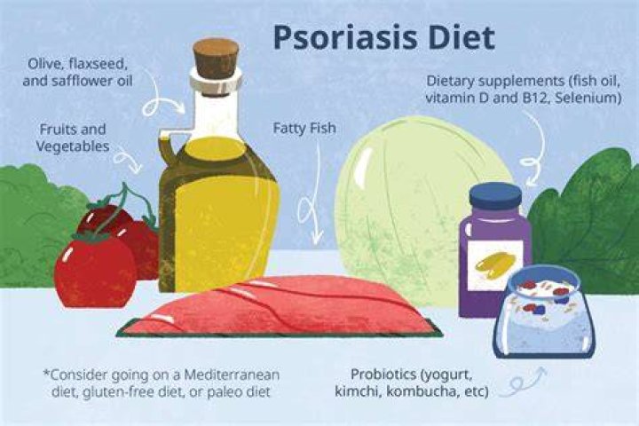 Is psoriasis food related?