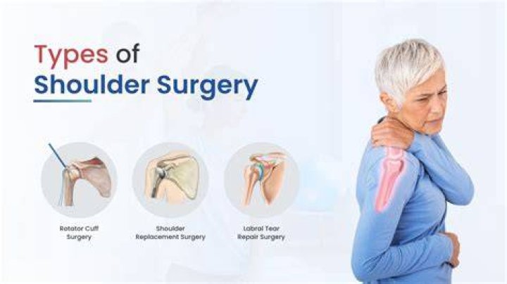 Is shoulder surgery major surgery?