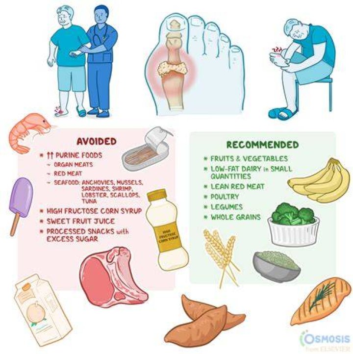 Is Spaghetti OK for gout?