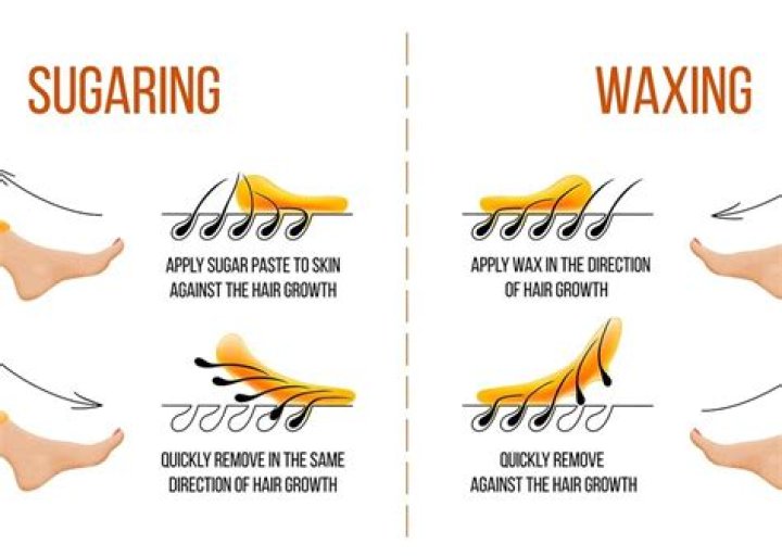 Is sugaring or waxing better for Brazilian?