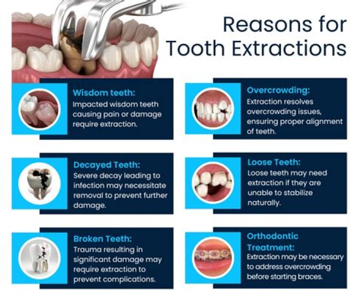 Is tooth extraction fast?