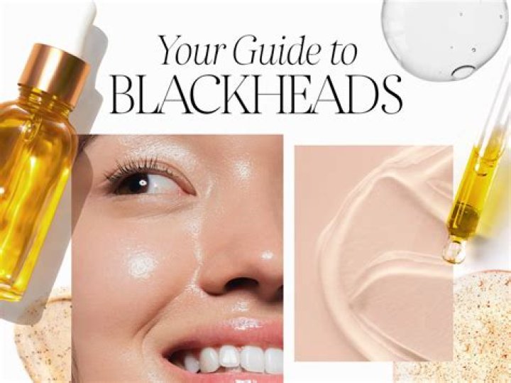 Is turmeric good for blackheads?