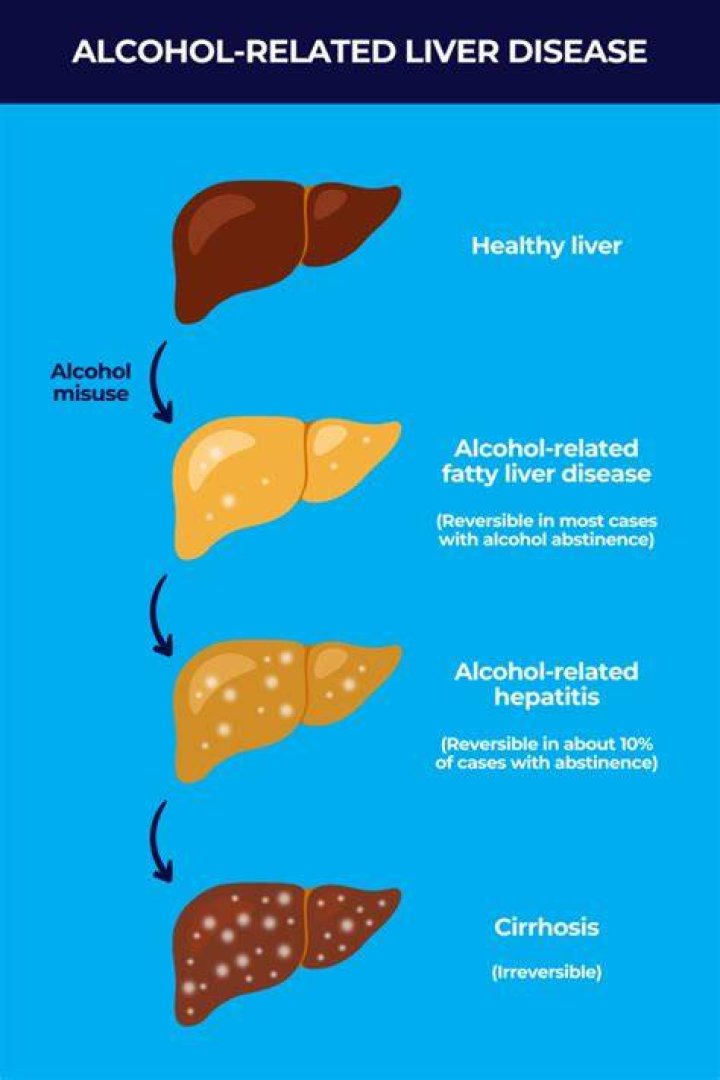 Is vodka or wine better for your liver?