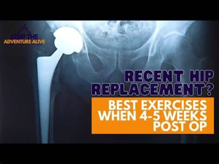Is walking the best exercise after hip replacement?