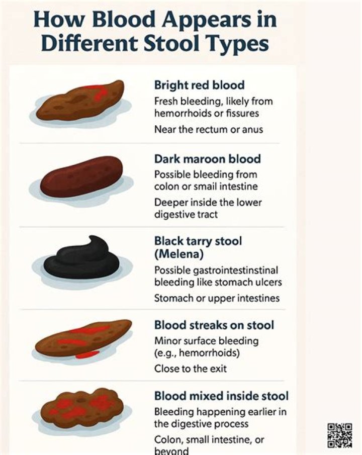 Should I go to the hospital for bloody diarrhea?