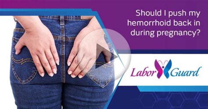 Should I push my hemorrhoid back in?