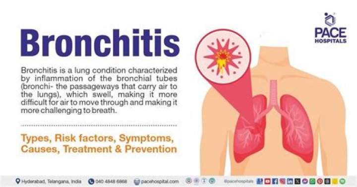 Should I take steroids for bronchitis?
