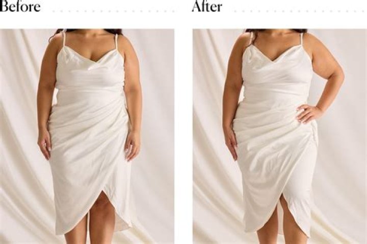 Should I wear Spanx after CoolSculpting?