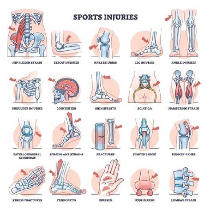 What are 3 common injuries in hockey?