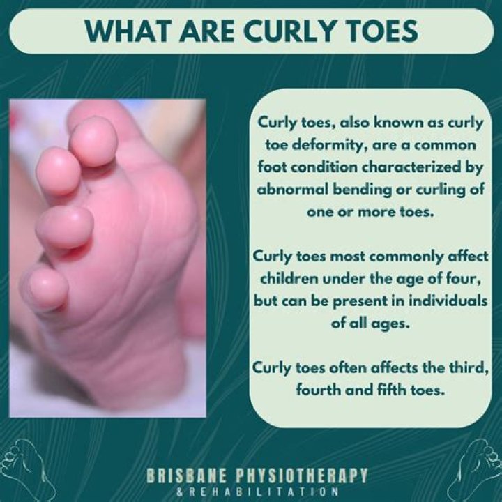 What are curly worms?