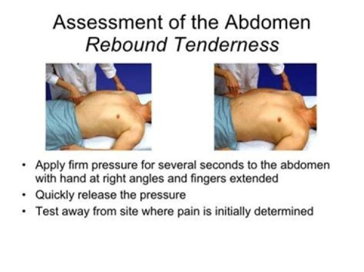 What are doctors looking for when they press on your stomach?
