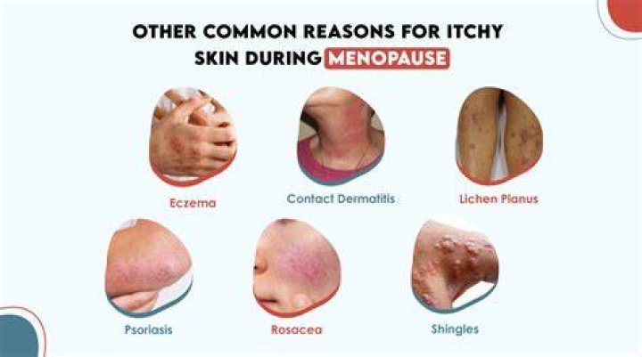 What are itchy arms a symptom of?