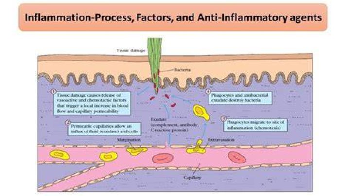 What are the main stages of inflammation?