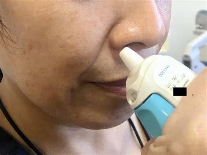 What are the side effect of Myra E 300?