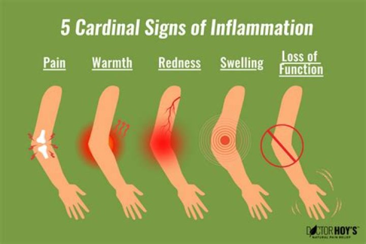 What are the signs of inflammation?
