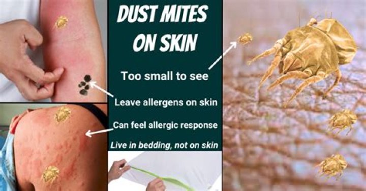 What are the signs of mites?