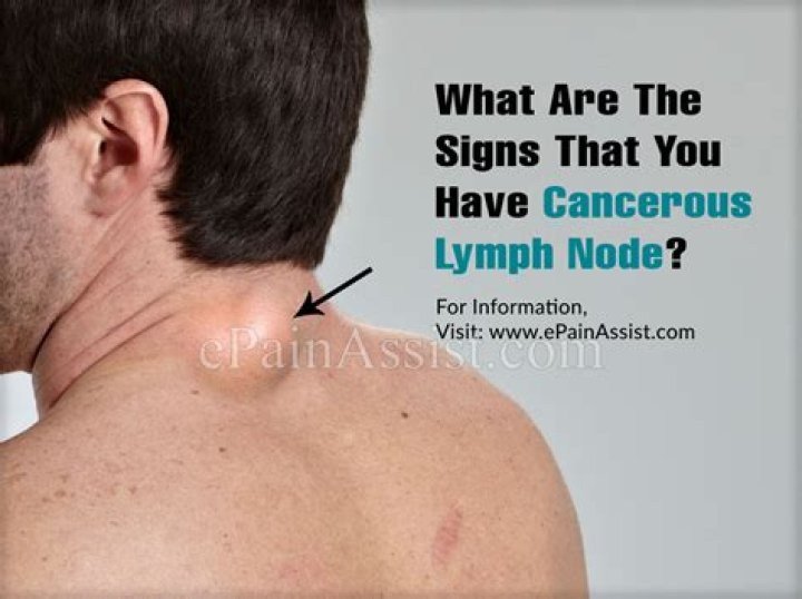 What are the signs that you have a cancerous lymph node?