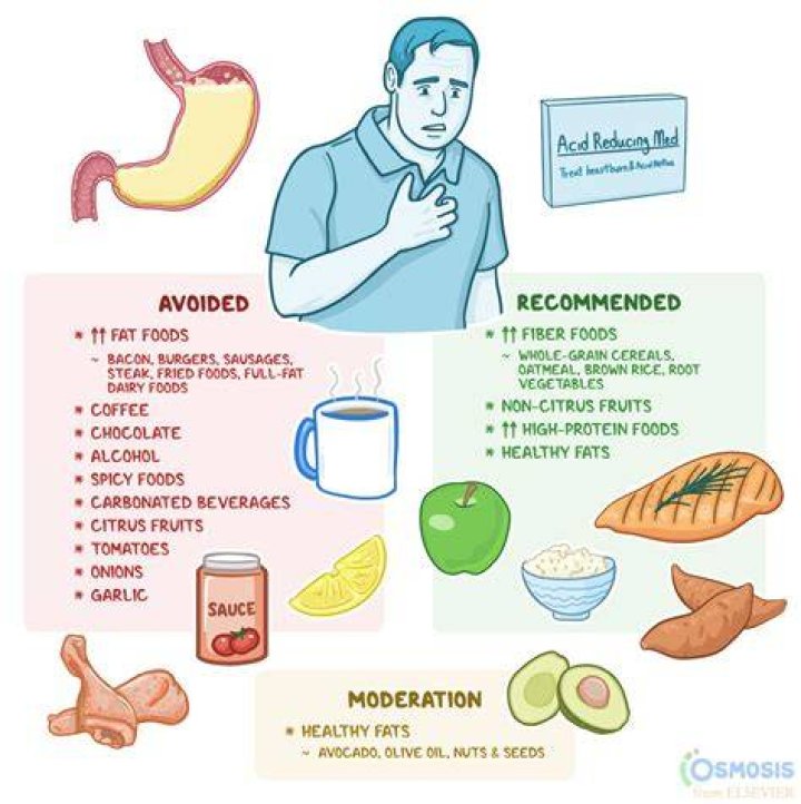 What are the symptoms of stomach acid?