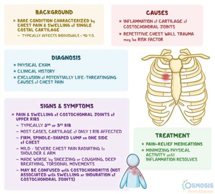What autoimmune disease causes costochondritis?
