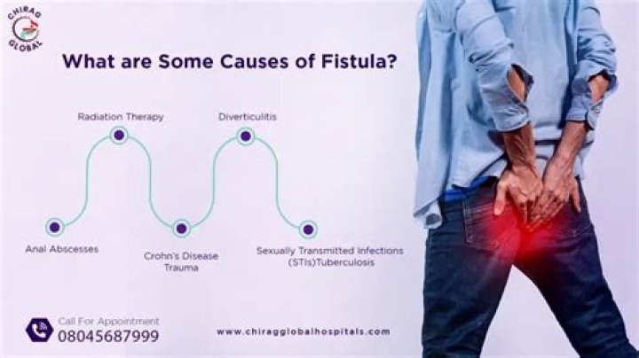 What bacteria causes Fistulous?