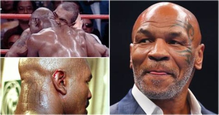 What boxer bit an ear off?