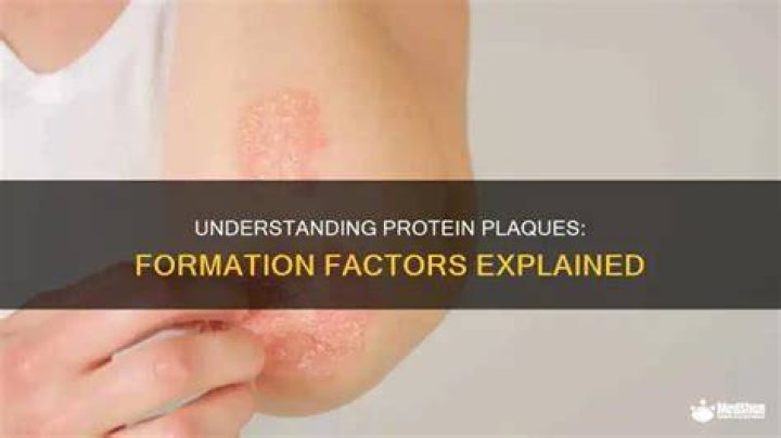 What causes protein plaques to form?