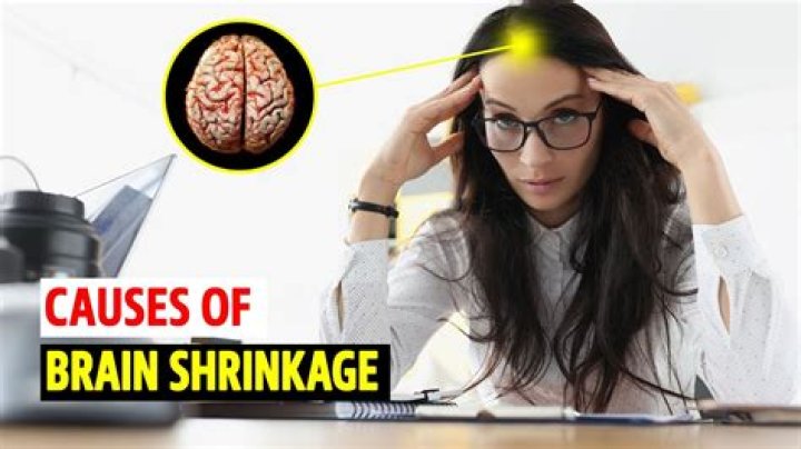 What causes the brain to shrink?