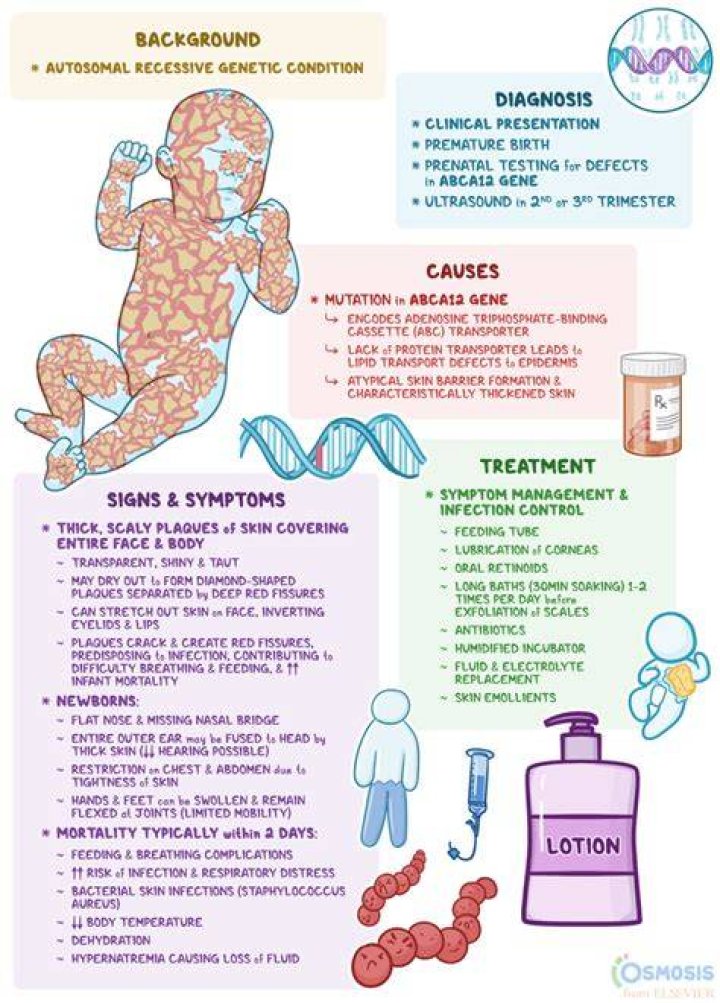 What creams are good for ichthyosis?