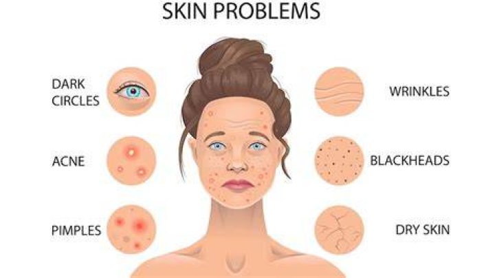 What deficiency causes dry skin?