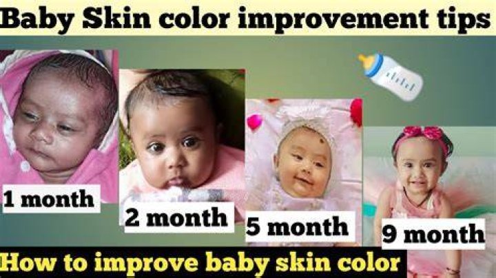What determines baby skin color?