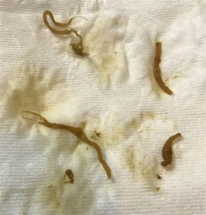 What do worms look like in human poop?