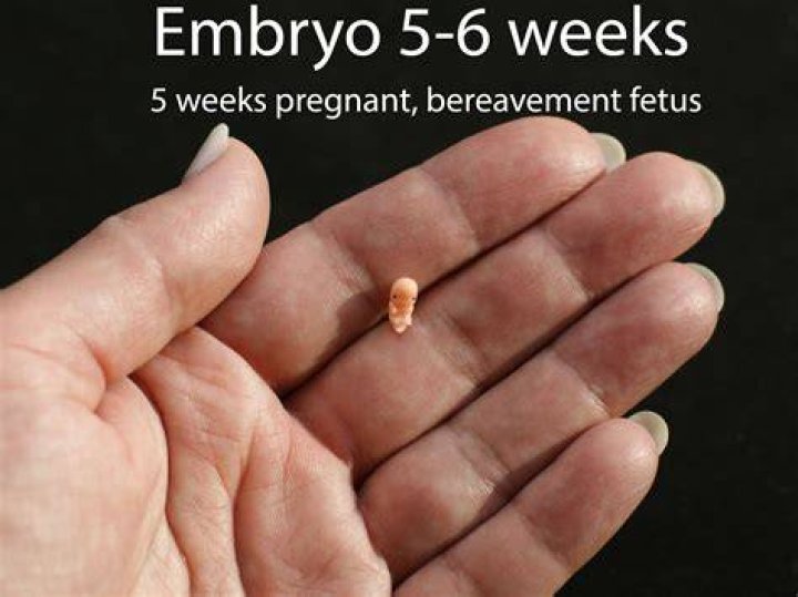 What does 5 week miscarriage tissue look like?