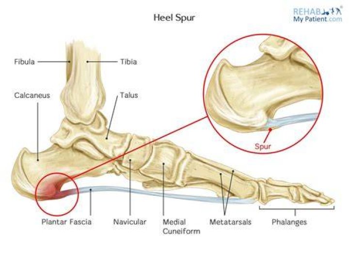 What does a heel hook damage?