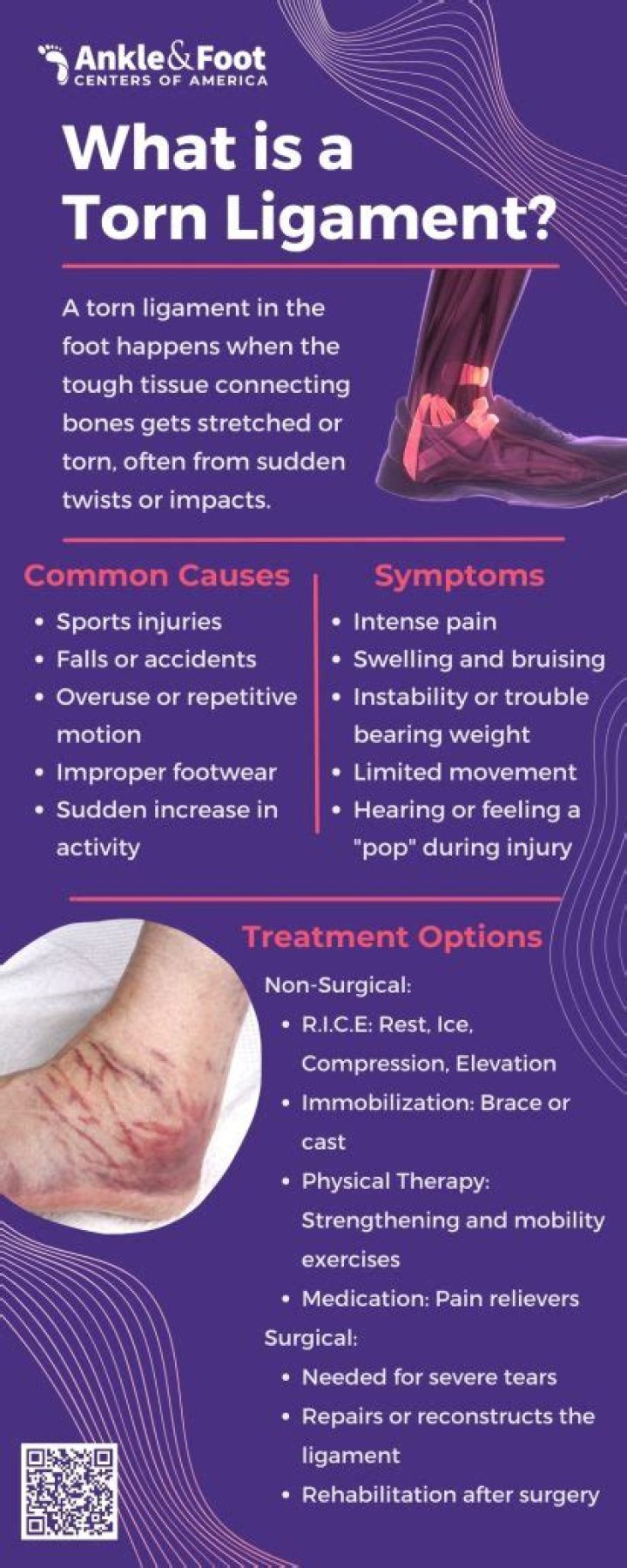 What does a torn ligament in foot feel like?