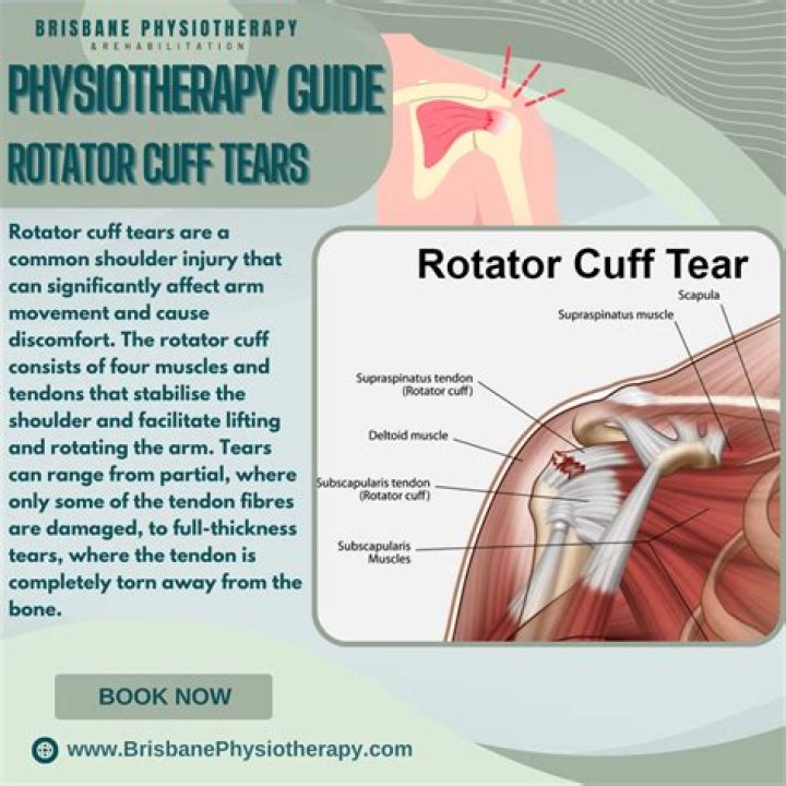 What does an inflamed rotator cuff feel like?