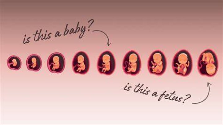 What does baby's breath symbolize?