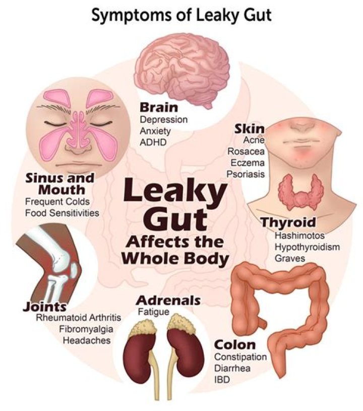 What does leaky gut feel like?