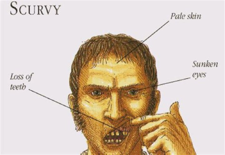 What does scurvy mean in pirate?